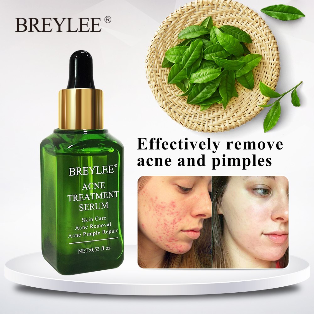 BREYLEE Acne Treatment Serum Facial Scar Removal Cream Whitening Repair Skin Care