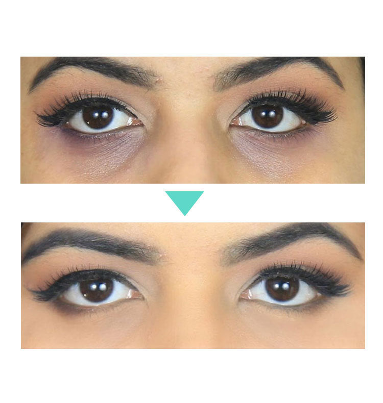 “BrightEyes 30ml — Illuminate & Revitalize Your Gaze”