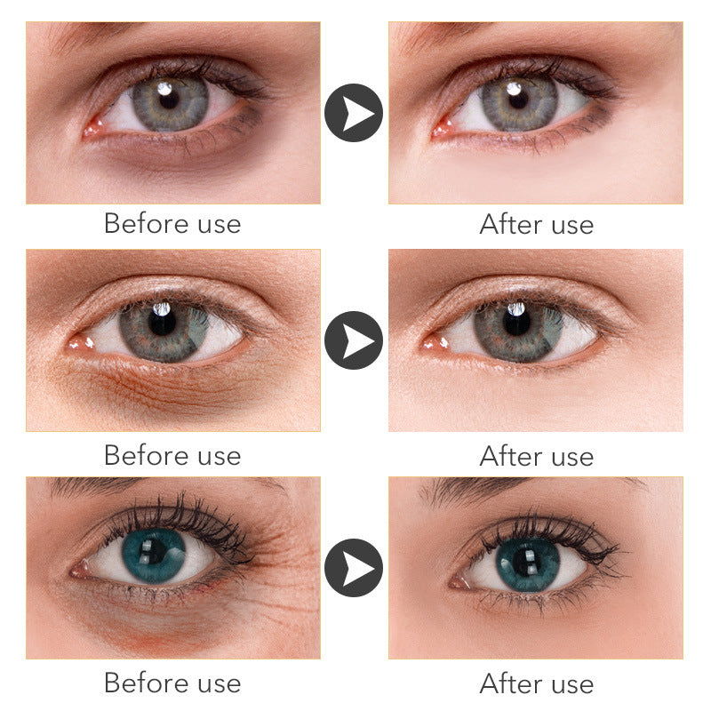 “BrightEyes 30ml — Illuminate & Revitalize Your Gaze”
