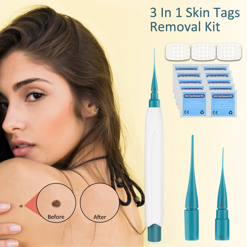 Auto Skin Tag Remover Kit